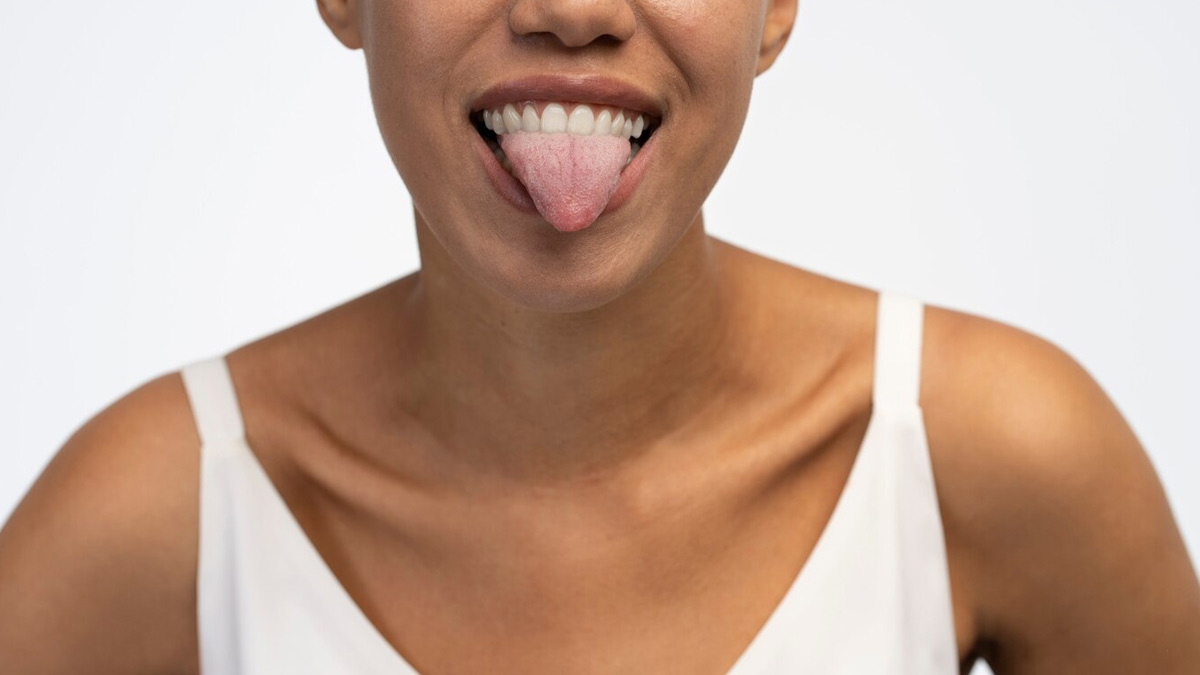 Tongue Warts: How Kissing Increases The Risk Of Transmission