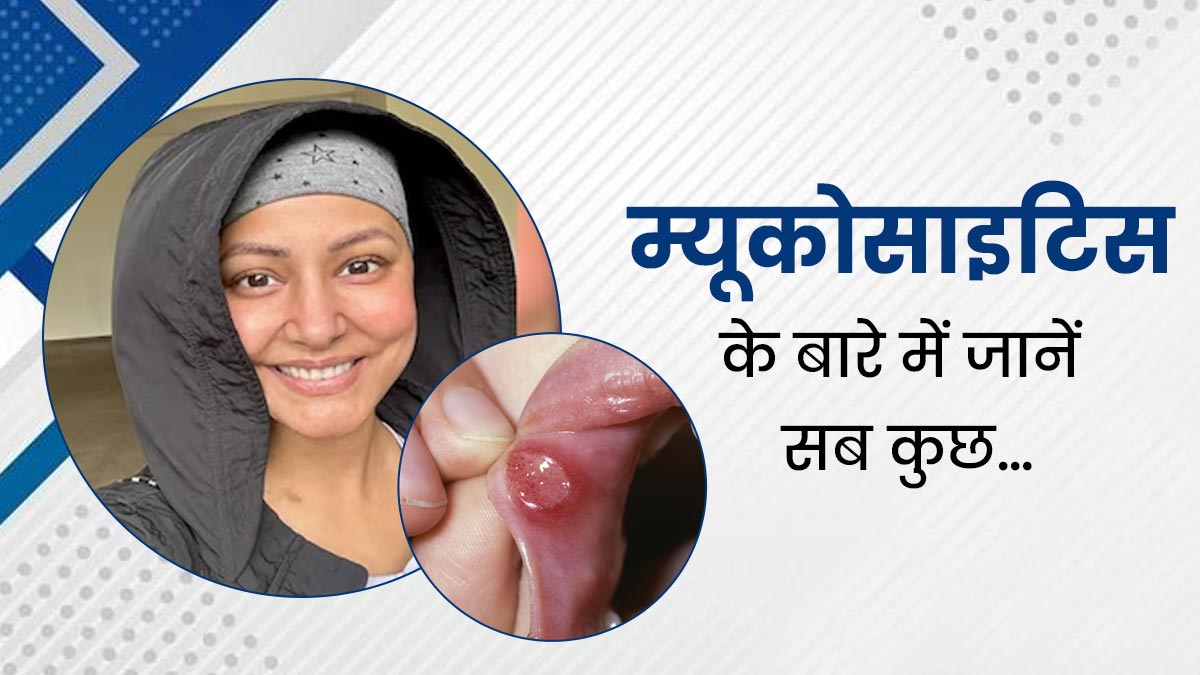 म्यूकोसाइटिस क्या है, जिससे जूझ रही हैं एक्ट्रेस हिना खान, जानें इस बीमारी से जुड़ी जरूरी जानकारियां