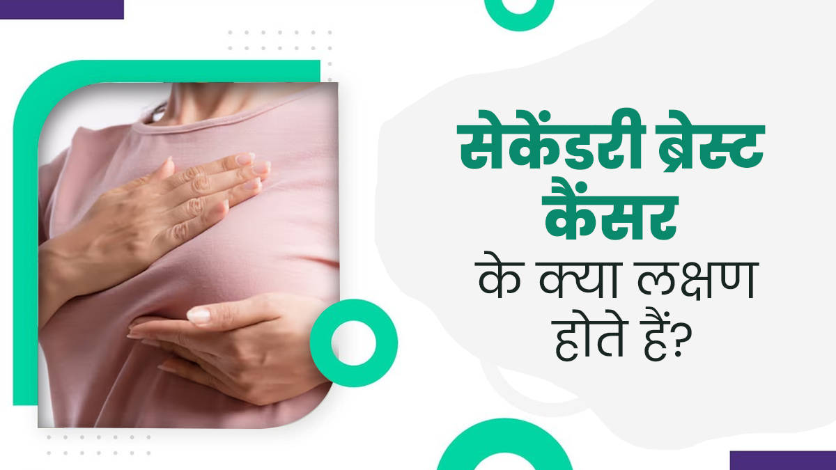  शरीर के दूसरे हिस्सों तक फैल गया है ब्रेस्ट से शुरू हुआ कैंसर? जानें सेकेंडरी ब्रेस्ट कैंसर के लक्षण