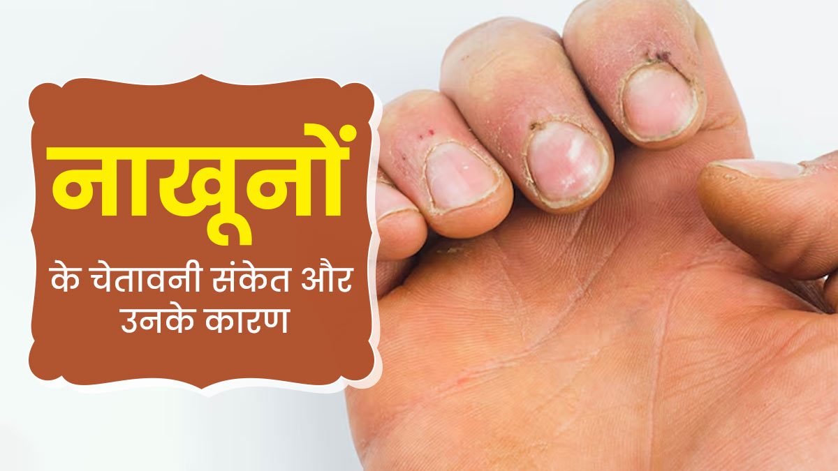 नाखूनों में दिखें ये 10 संकेत तो हो जाए अलर्ट, गंभीर बीमारी का हो सकता है लक्षण