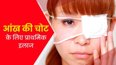 आंख में चोट लगने पर तुरंत अपनाएं फर्स्ट एड ट्रीटमेंट, ब्लीडिंग और दर्द से होगा बचाव
