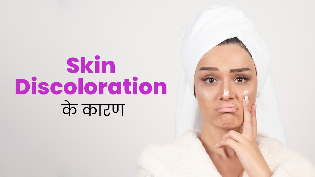 त्वचा की रंगत में अचानक आने लगा बदलाव? जानें क्या हो सकते हैं Skin Discoloration के कारण