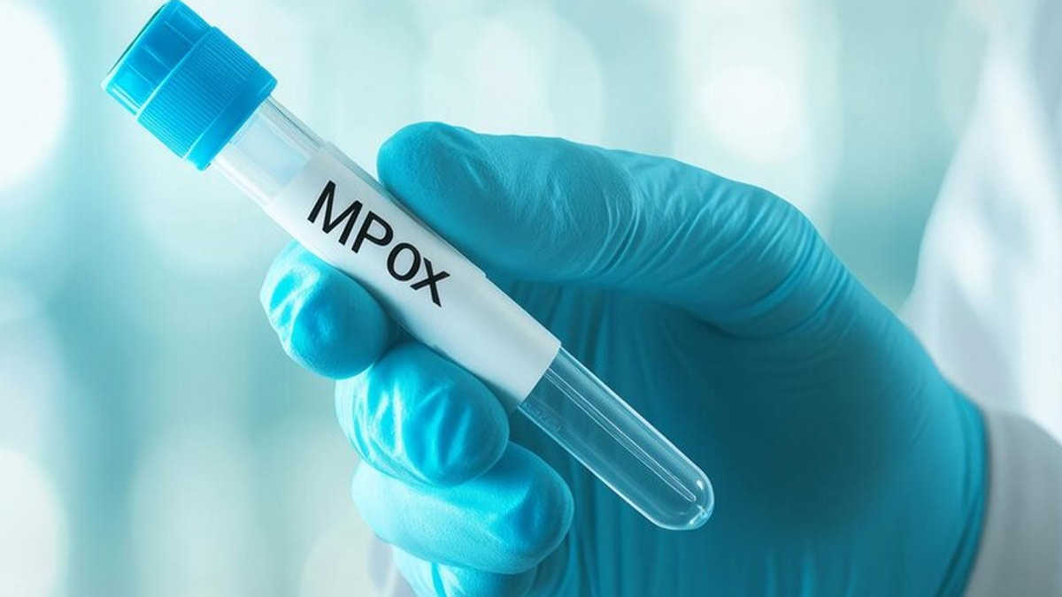 Is Mpox An Infectious Disease? Are Mpox Cases Alarming? Here’s What Do We Need To Know