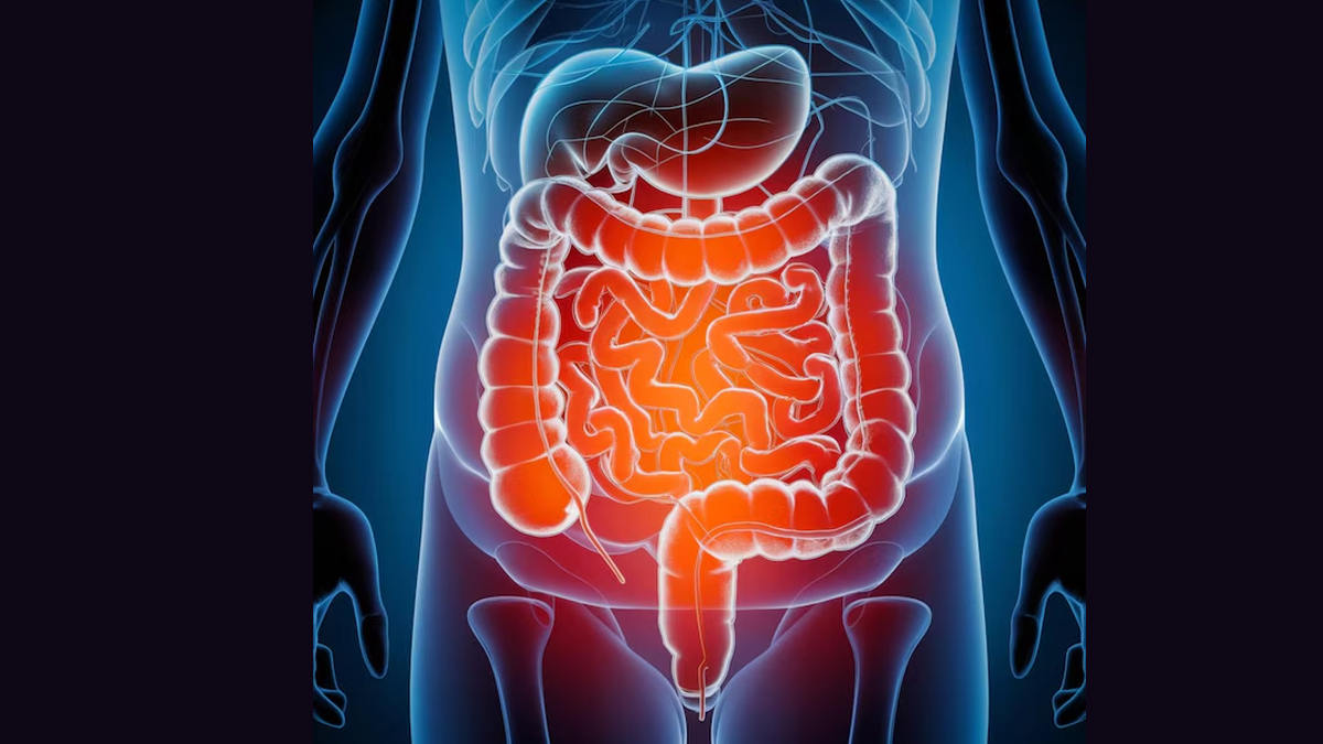 What Are Some Unusual Symptoms Of Colon Cancer In Hindi