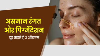 चेहरे की असमान रंगत और प‍िग्‍मेंटेशन को दूर करते हैं ये 3 नेचुरल ऑयल, न‍िखार के ल‍िए इस तरह करें प्रयोग