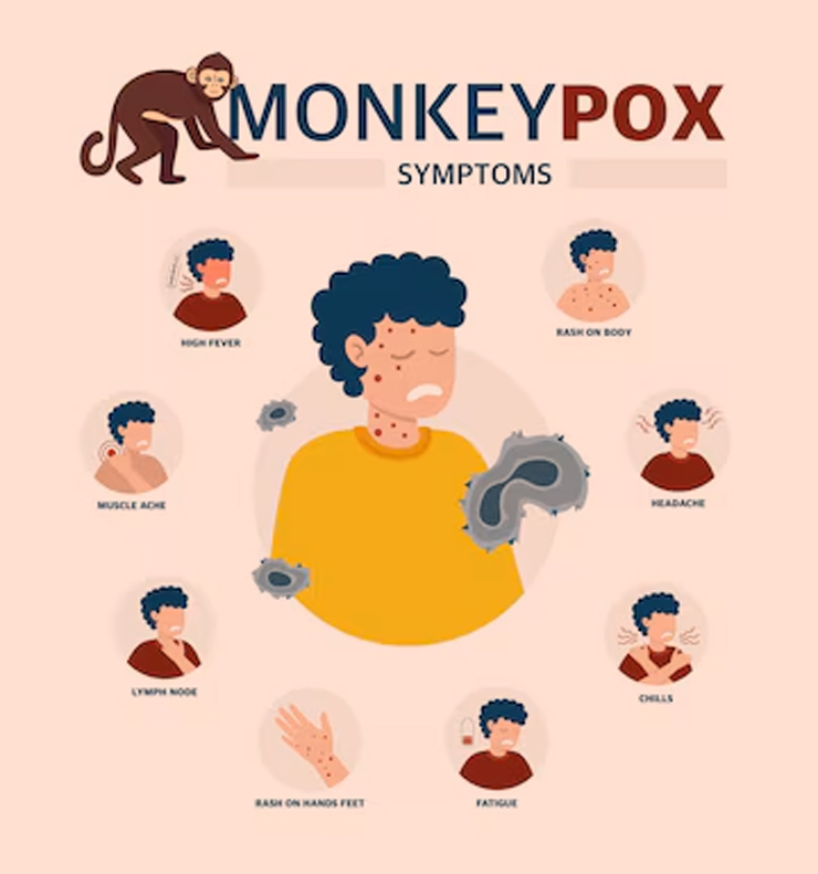 Mpox