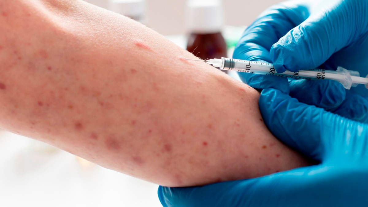 Mpox Myths And Facts In Hindi