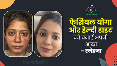 चेहरा लाल होना की बीमारी (रोजेशिया) से परेशान थीं हेल्थ कोच स्नेहजा, जानें डाइट और योग से कैसे ठीक की समस्या?