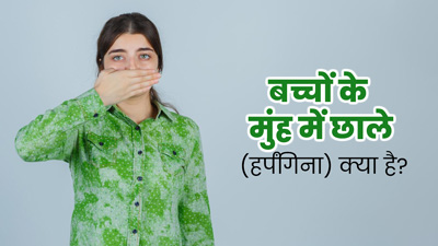 बच्चों में हर्पंगिना (मुंह में छाले) की समस्या क्यों होती है? जानें इसके लक्षण, कारण और इलाज