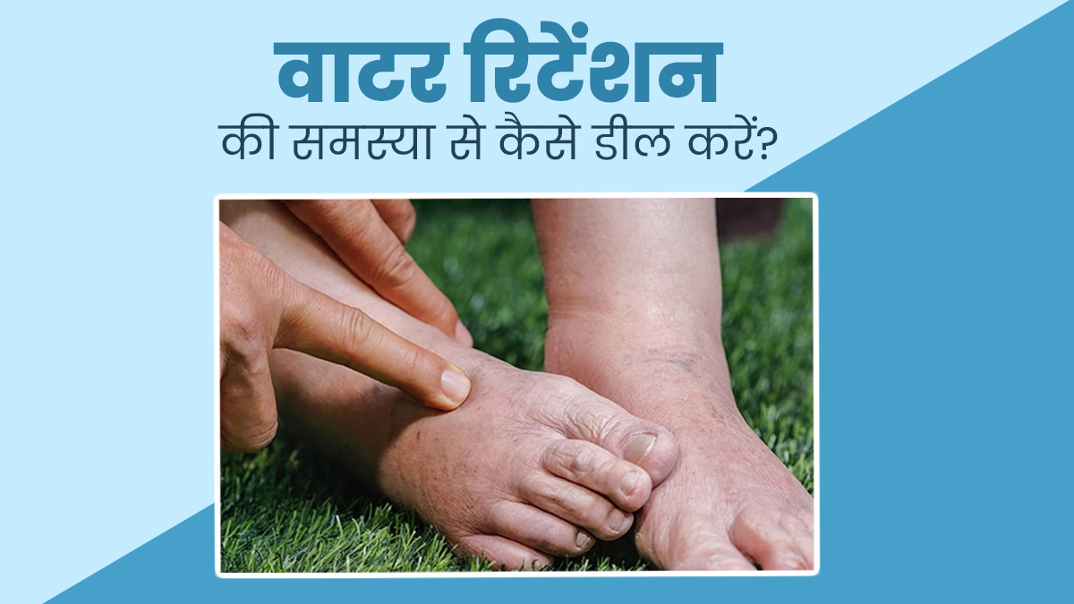 शरीर में पानी जमा होने (वाटर रिटेंशन) की समस्या से डील करने के लिए अपनाएं ये 5 तरीके