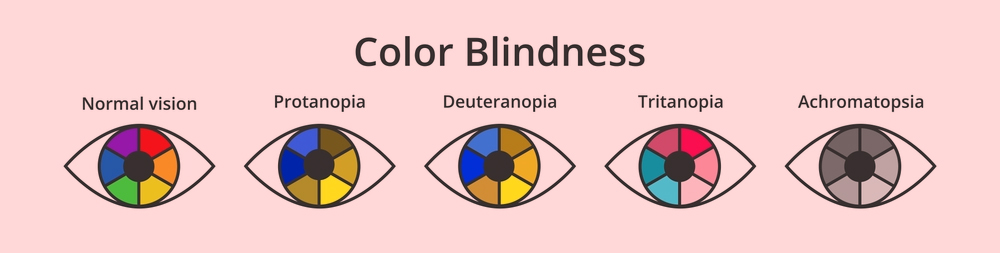 Colour blindness