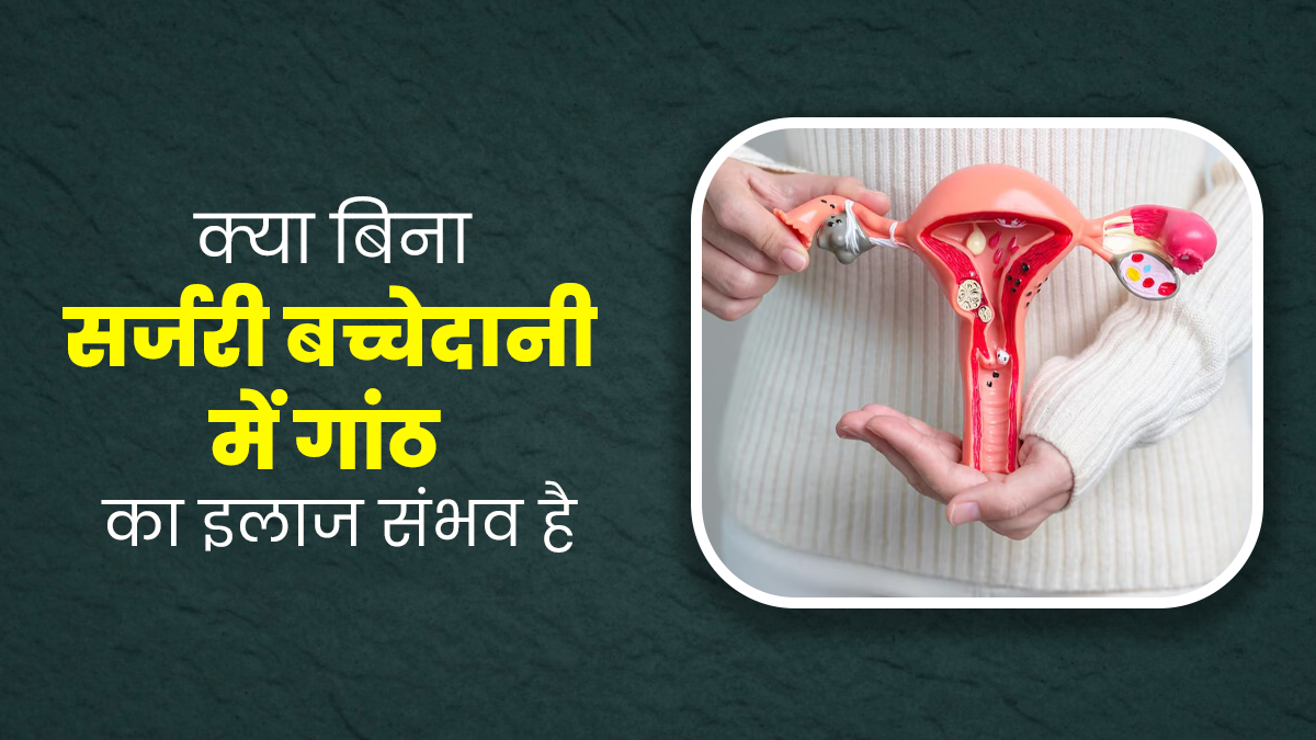 क्या बच्चेदानी में गांठ का इलाज बिना ऑपरेशन के किया जा सकता है? डॉक्टर से जानें 