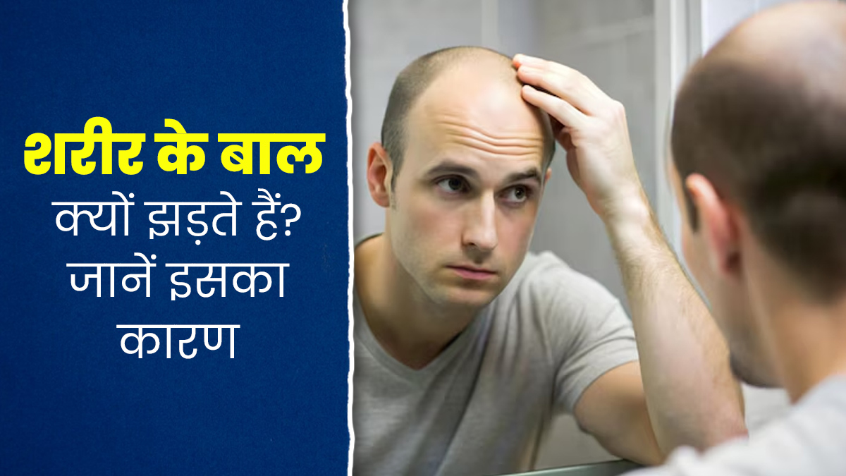 Alopecia Universalis: इस समस्या में झड़ जाते हैं सिर और शरीर के सारे बाल, जानें इसके लक्षण और कारण 