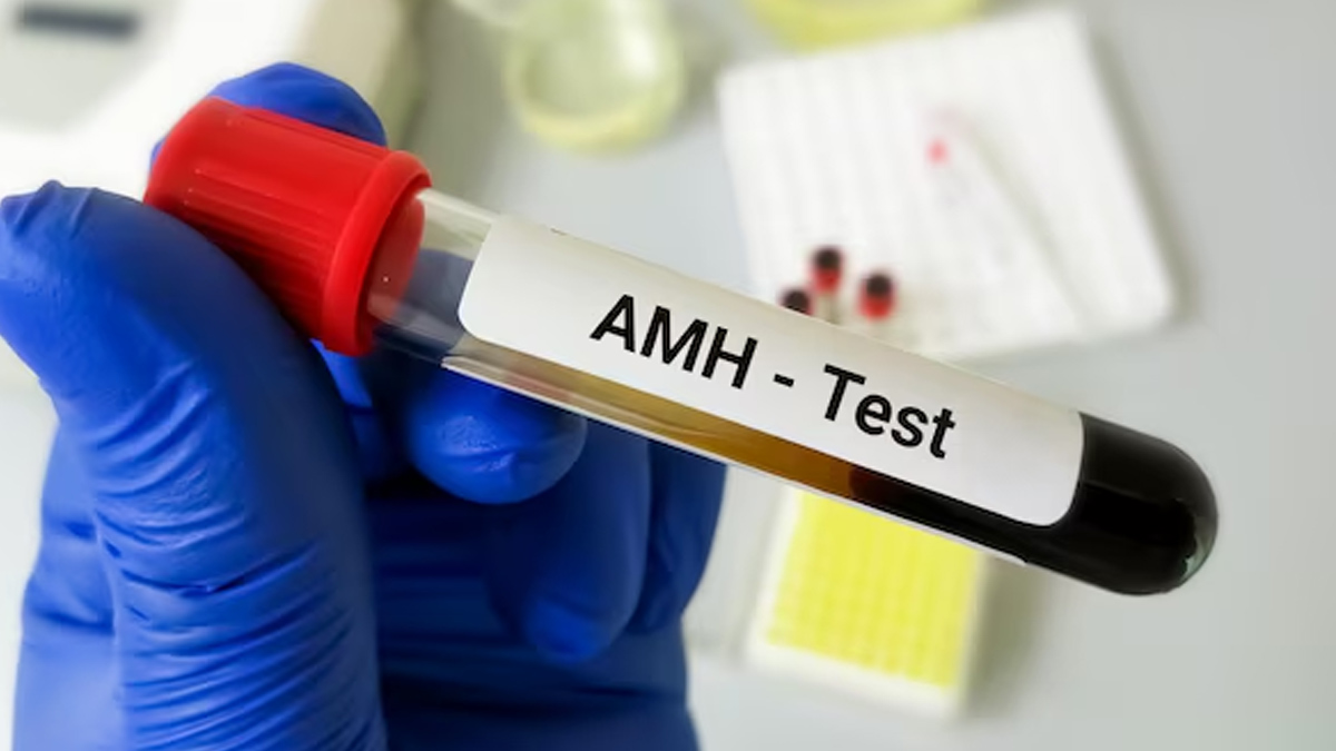 AMH test
