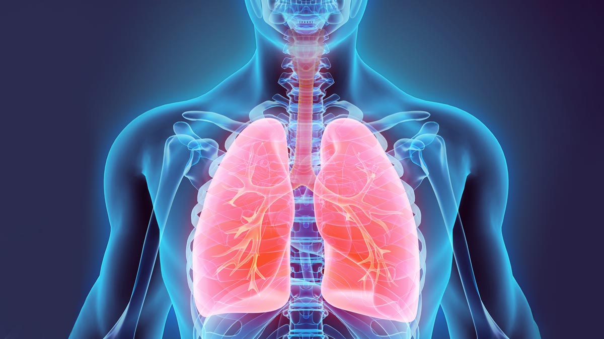 PM2.5 Exposure May Increase Lung Cancer Risk in Women Who Have Never Smoked