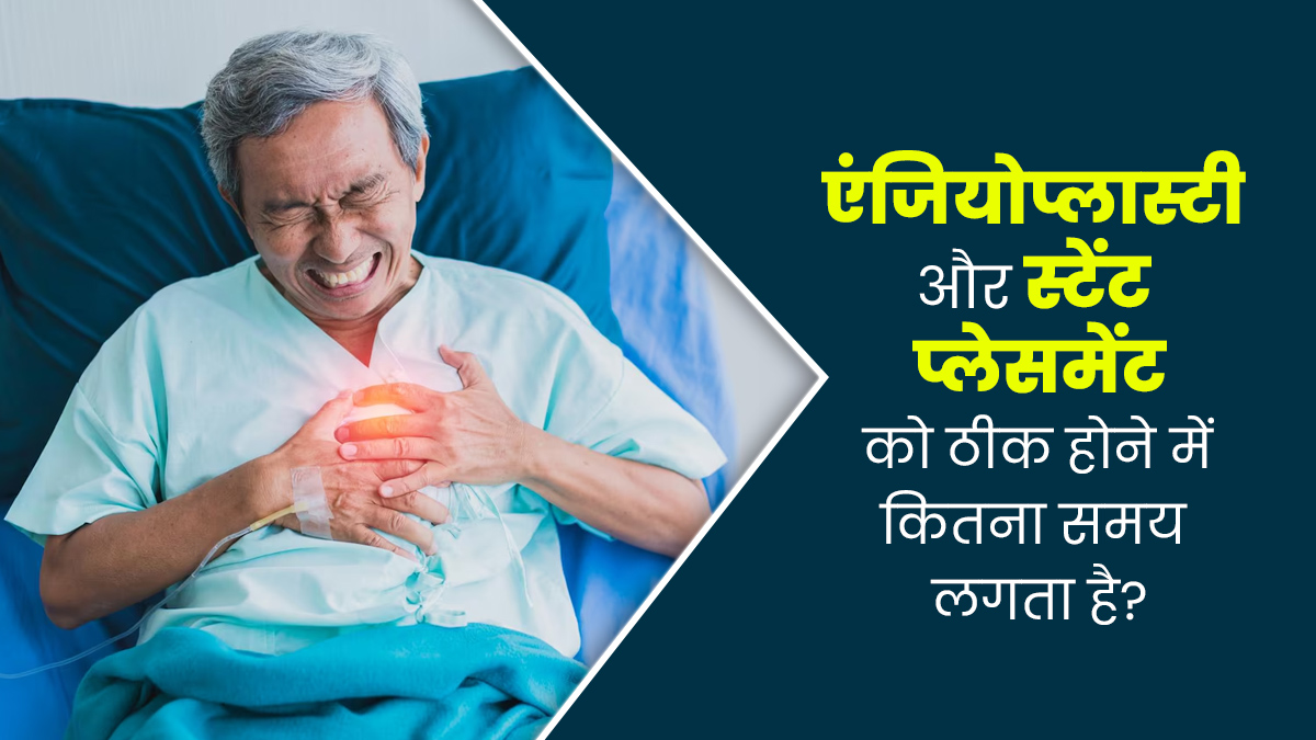एंजियोप्लास्टी और स्टेंट प्लेसमेंट के बाद रिकवरी में कितना समय लगता है? डॉक्टर से जानें