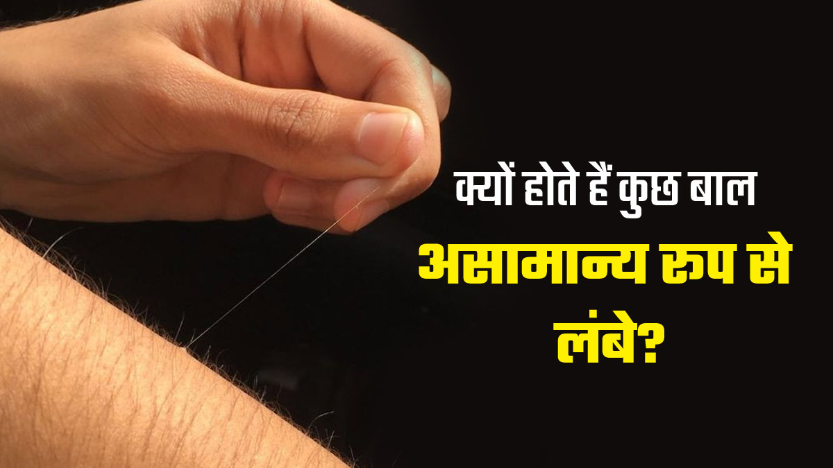 शरीर के कुछ हिस्सों पर बाल क्यों हो जाते हैं जल्दी लंबे? डॉक्टर से जानें कारण