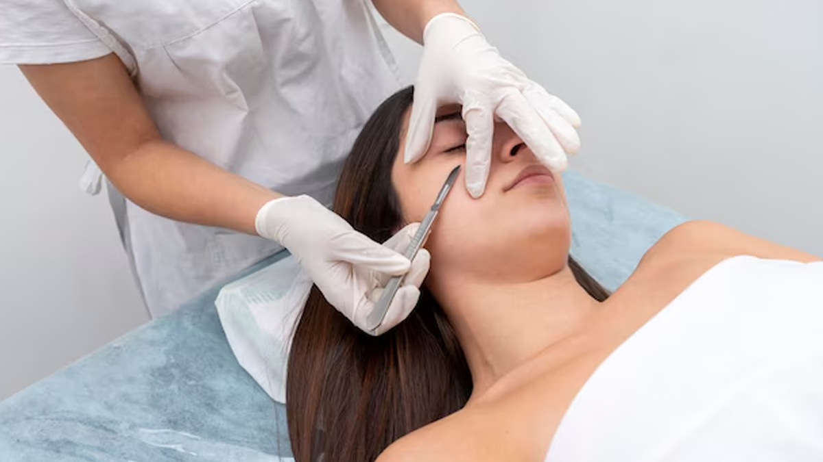 dermaplaning