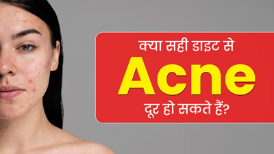 क्या सही डाइट की मदद से कील-मुंहासों की समस्या को कम किया जा सकता है? जानें एक्सपर्ट की राय