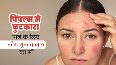 पिंपल्स से छुटकारा पाने के लिए लौंग और गुलाब जल स्प्रे का करें इस्तेमाल, दाग-धब्बे भी होंगे दूर