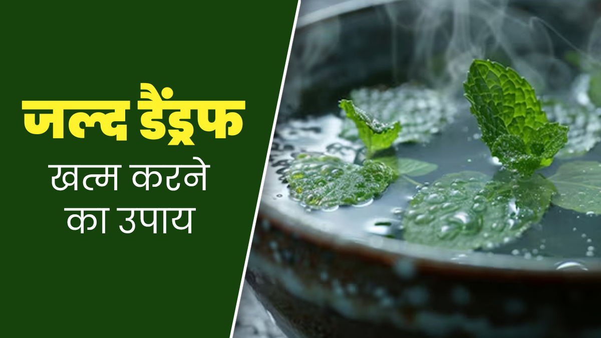 बालों पर जमा डैंड्रफ को जल्‍दी न‍िकालता है पुदीने का पानी, जानें इस्‍तेमाल का तरीका और फायदे 