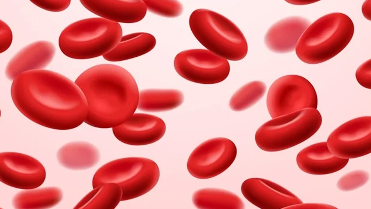 anemia