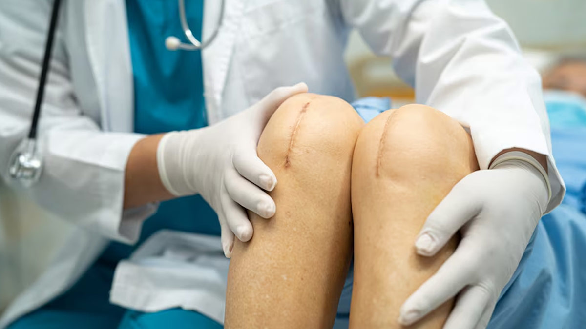 Robotic Knee Replacement Surgery: Doctor Explains Long-Term Benefits
