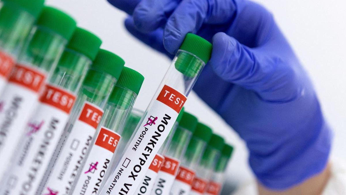 India Reports First Case of Mpox Clade1; WHO Declares Strain a Public Health Emergency