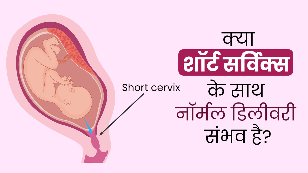 Short Cervix: क्या बच्चेदानी का मुंह छोटा होने पर नॉर्मल डिलीवरी संभव है? डॉक्‍टर से जानें 