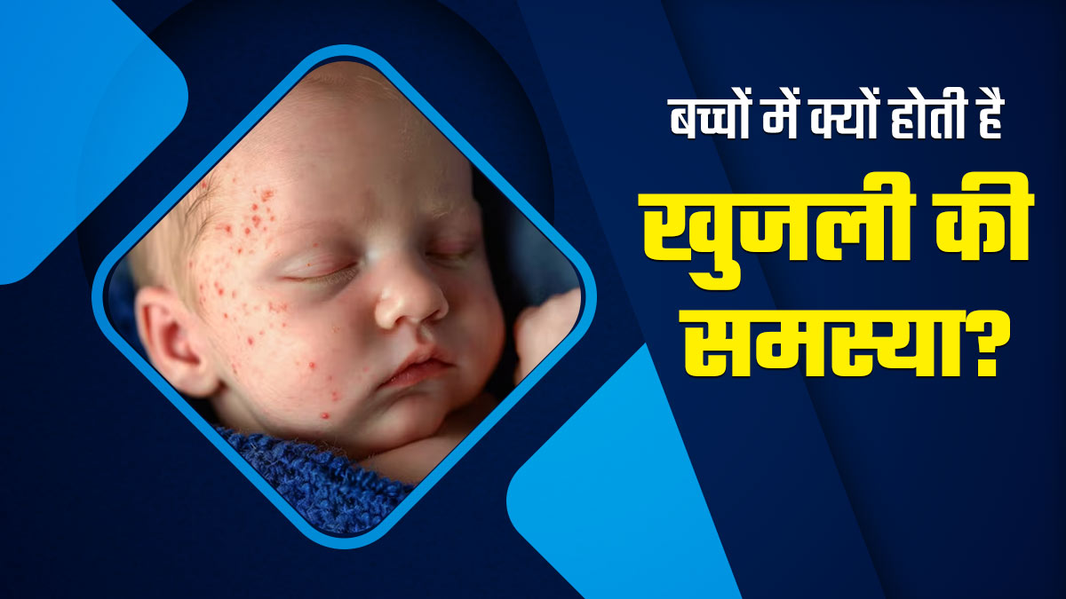 बच्चों को क्यों होती है स्कैबीज (खुजली) की समस्या? इससे बचाव के लिए पेरेंट्स जरूर ध्यान रखें ये 5 बातें