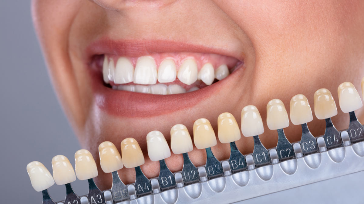The Rise Of Cosmetic Dentistry: How To Choose The Right Option For You