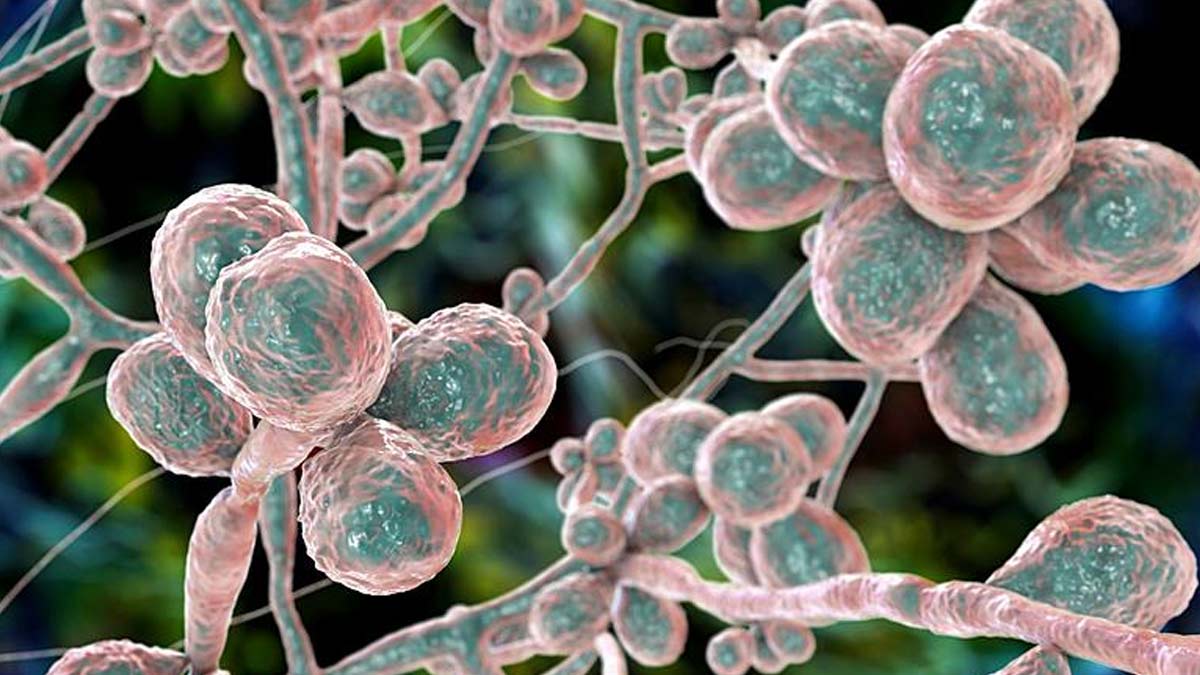 Scientists Warn Of Evolving Deadly Fungal Infections Leading To A "Silent Pandemic"