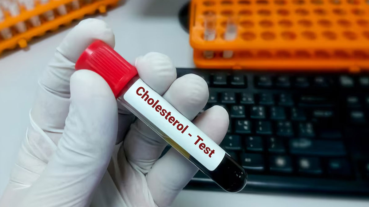 World Heart Day 2024: Why Early Cholesterol Screening Is Crucial For Young People