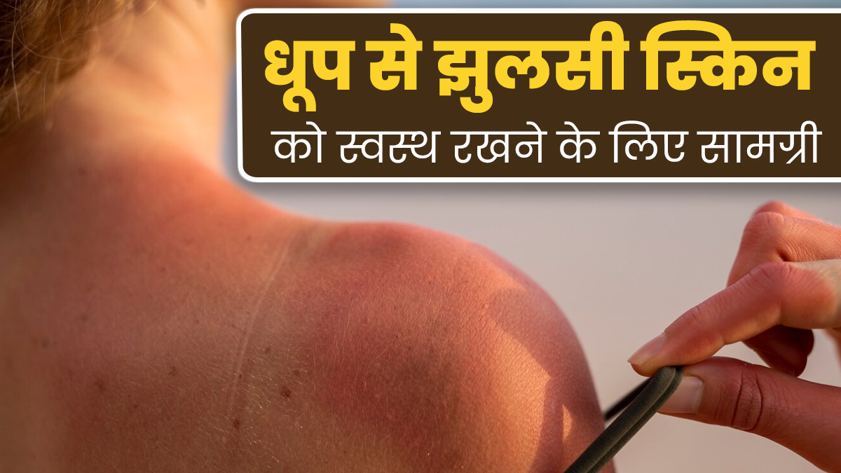 धूप से झुलसी त्वचा को ठीक करने के लिए इस्तेमाल करें ये 5 इंग्रीडिएंट्स, मिलेगा फायदा