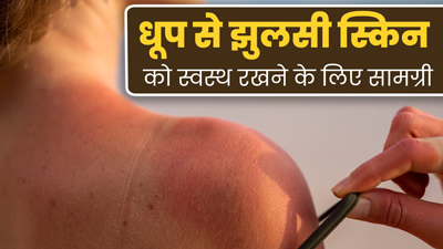 धूप से झुलसी त्वचा को ठीक करने के लिए इस्तेमाल करें ये 5 इंग्रीडिएंट्स, मिलेगा फायदा