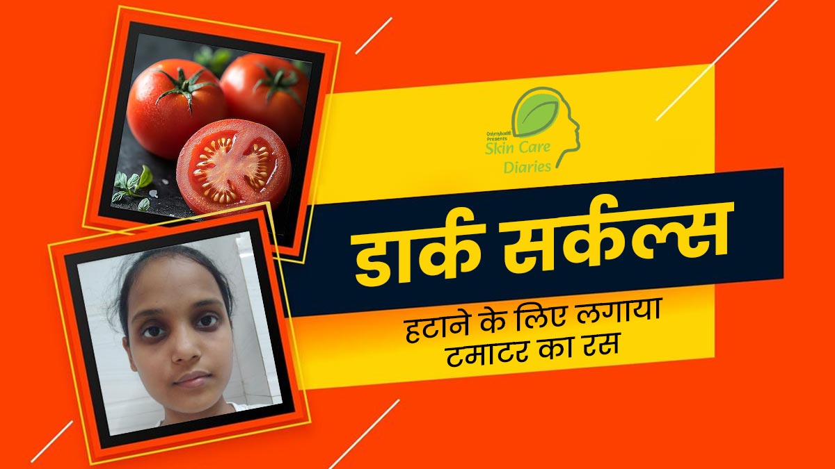 देर रात तक पढ़ने की वजह से अंशु के आंखों के नीचे हो गए थे काले घेरे, टमाटर का रस लगाने से मिला फायदा
