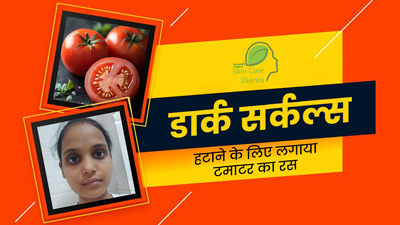 देर रात तक पढ़ने की वजह से अंशु के आंखों के नीचे हो गए थे काले घेरे, टमाटर का रस लगाने से मिला फायदा