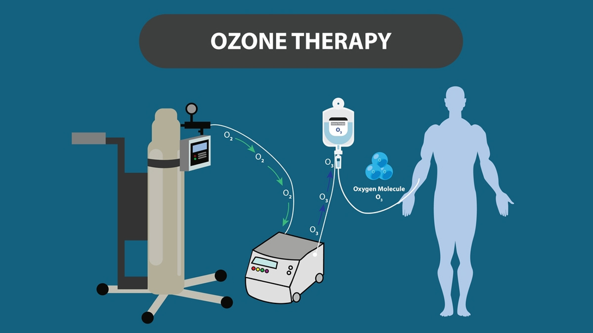 Power of Ozone Therapy: Expert Explains How Ozone Therapy Can Benefit Your Overall Health