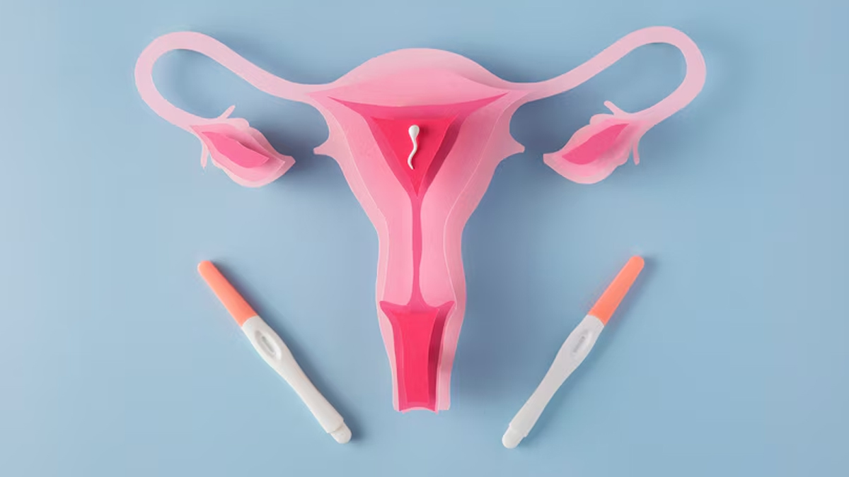 PCOS