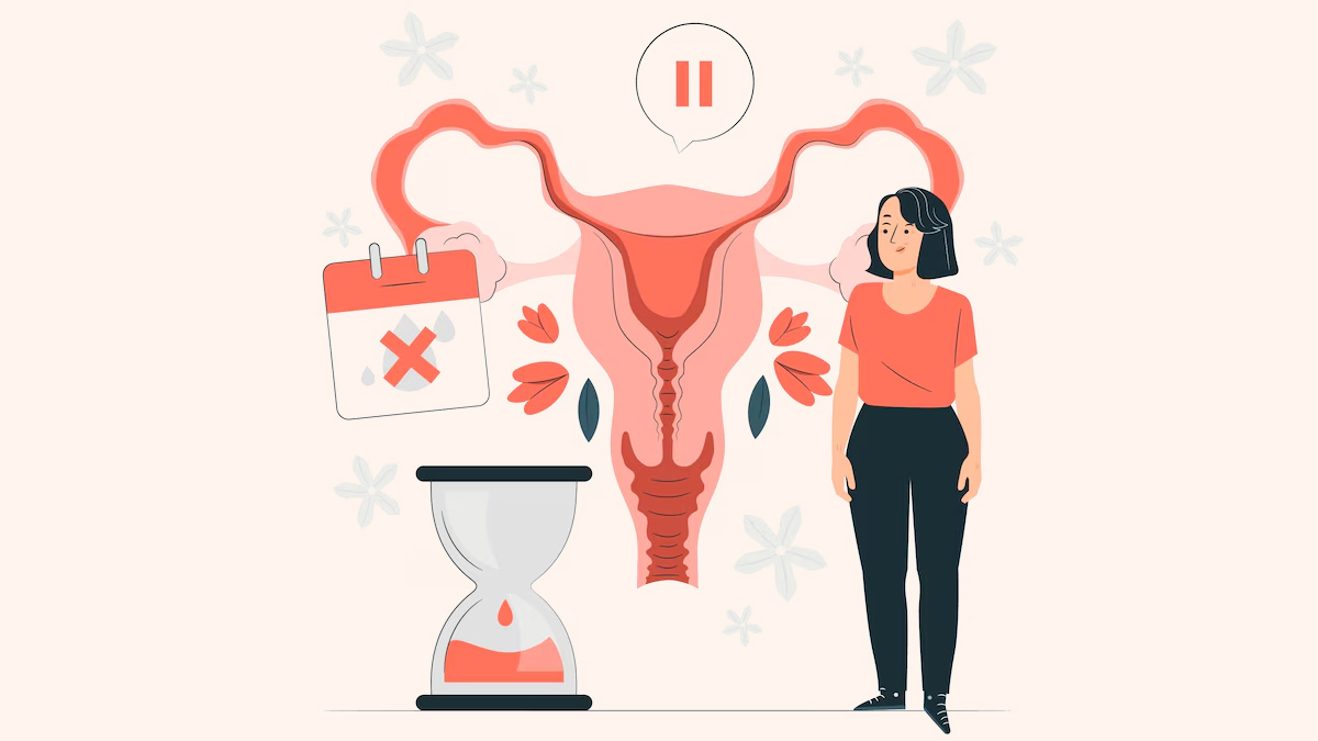 PCOS