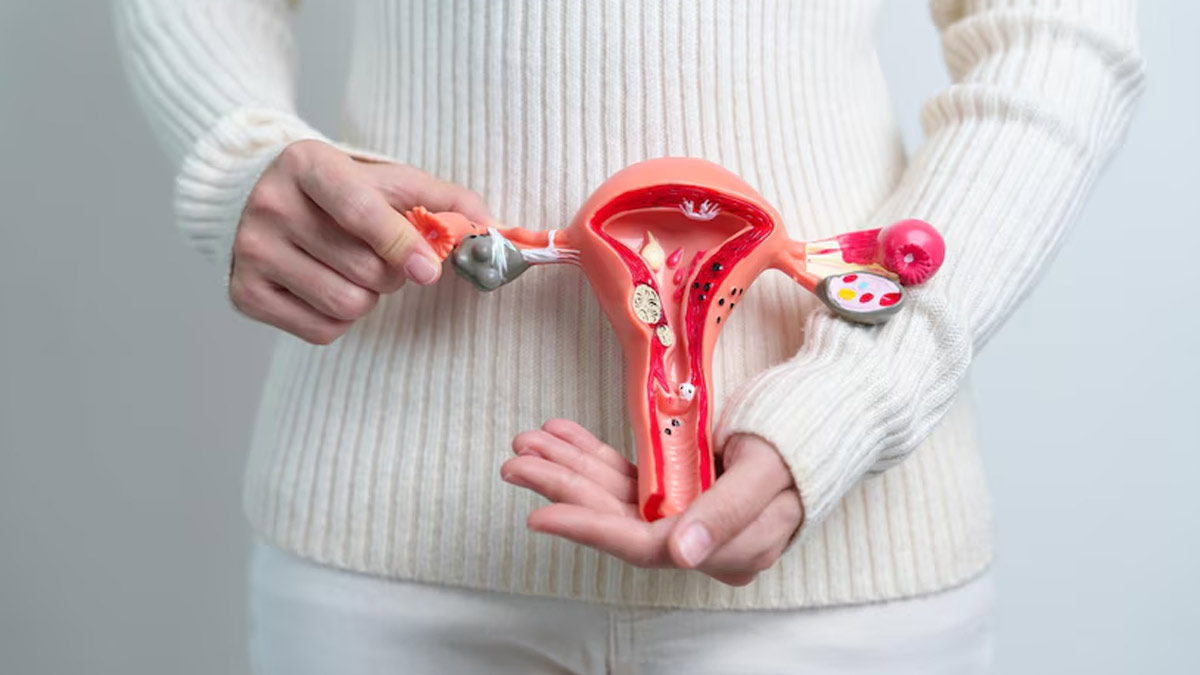 PCOS Awareness Month: How Does It Affect Women At Different Stages of Life