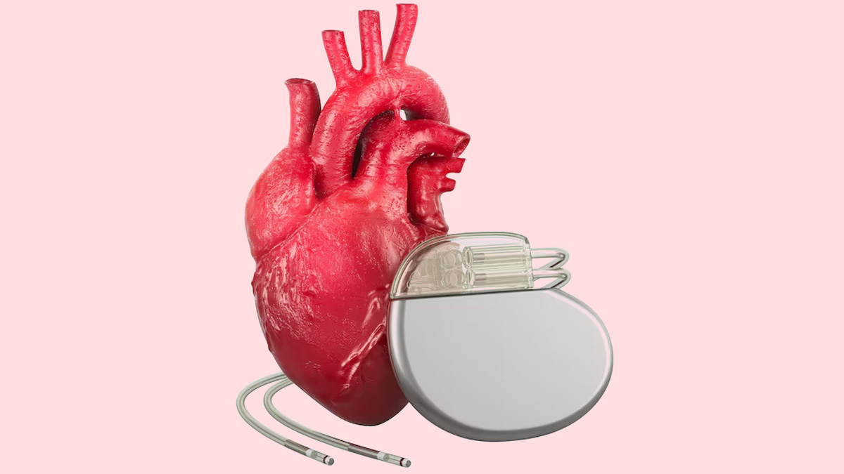 World Heart Day 2024: Is Your Pacemaker Malfunctioning? Key Warning Signs to Watch For