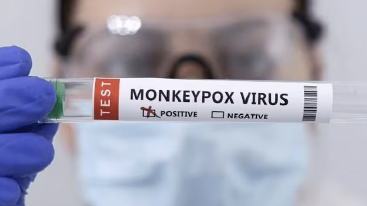 Mpox