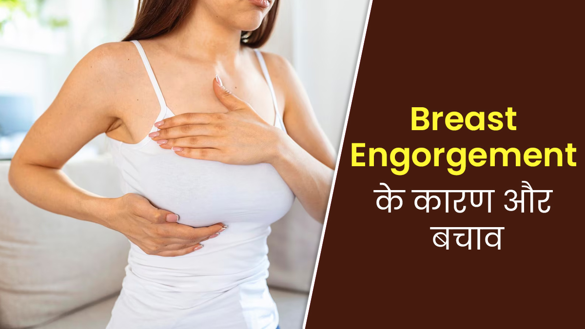 डिलीवरी के बाद स्तन में दूध की अधिकता होना होता है Breast Engorgement, जानें इसके कारण और बचाव
