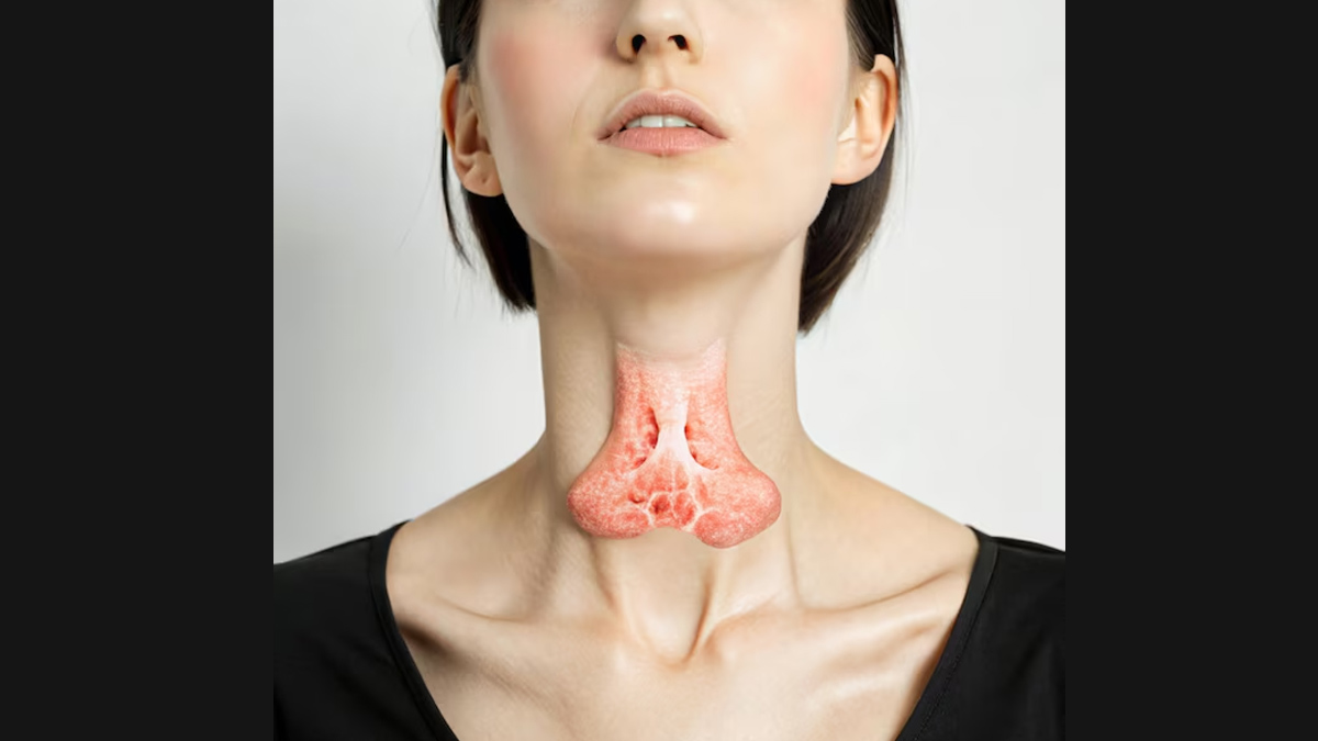 Which diseases cause constipation In Hindi