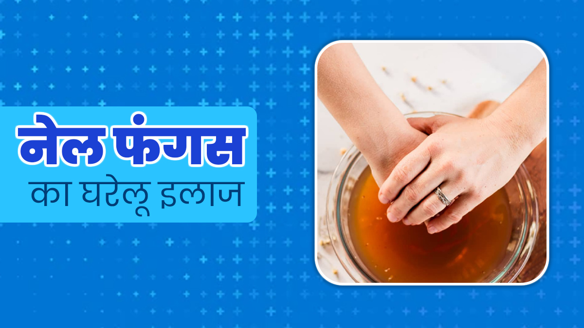 नाखून में फंगल इंफेक्‍शन दूर करता है एप्‍पल साइडर व‍िनेगर, जानें इस्‍तेमाल का सही तरीका 