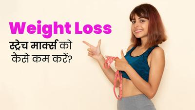 वेट लॉस के कारण होने लगे हैं स्ट्रेच मार्क्स, जानें इन्हें कम करने के टिप्स