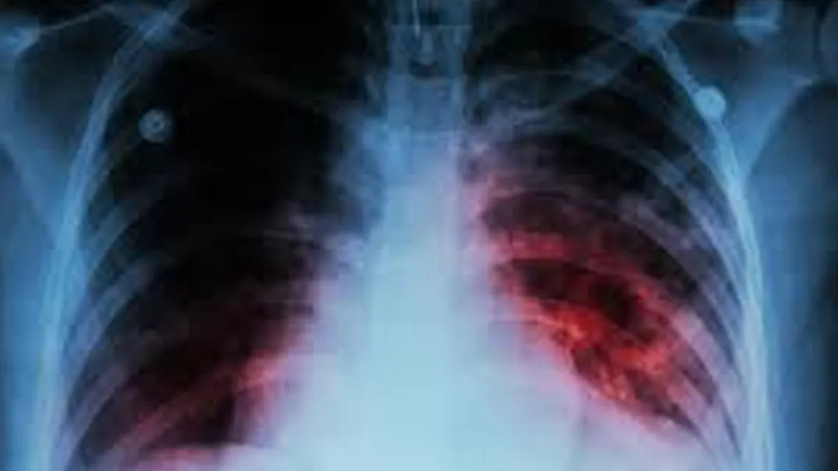 WHO Report Highlights India's High TB Treatment Coverage And Surge In Preventive Therapy Efforts