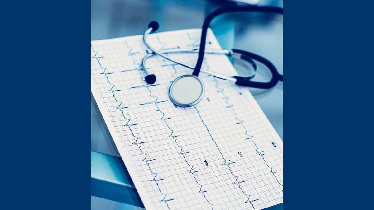 Electrocardiogram