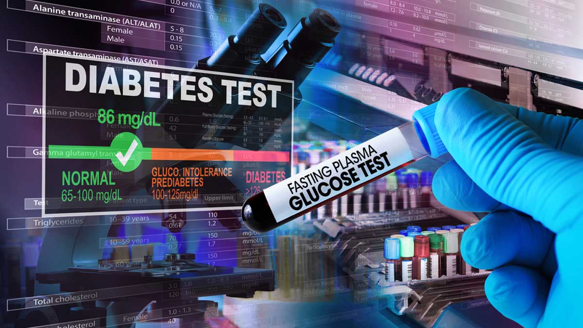 Fasting Plasma Glucose Test Expert Lists Essential Guidelines Before